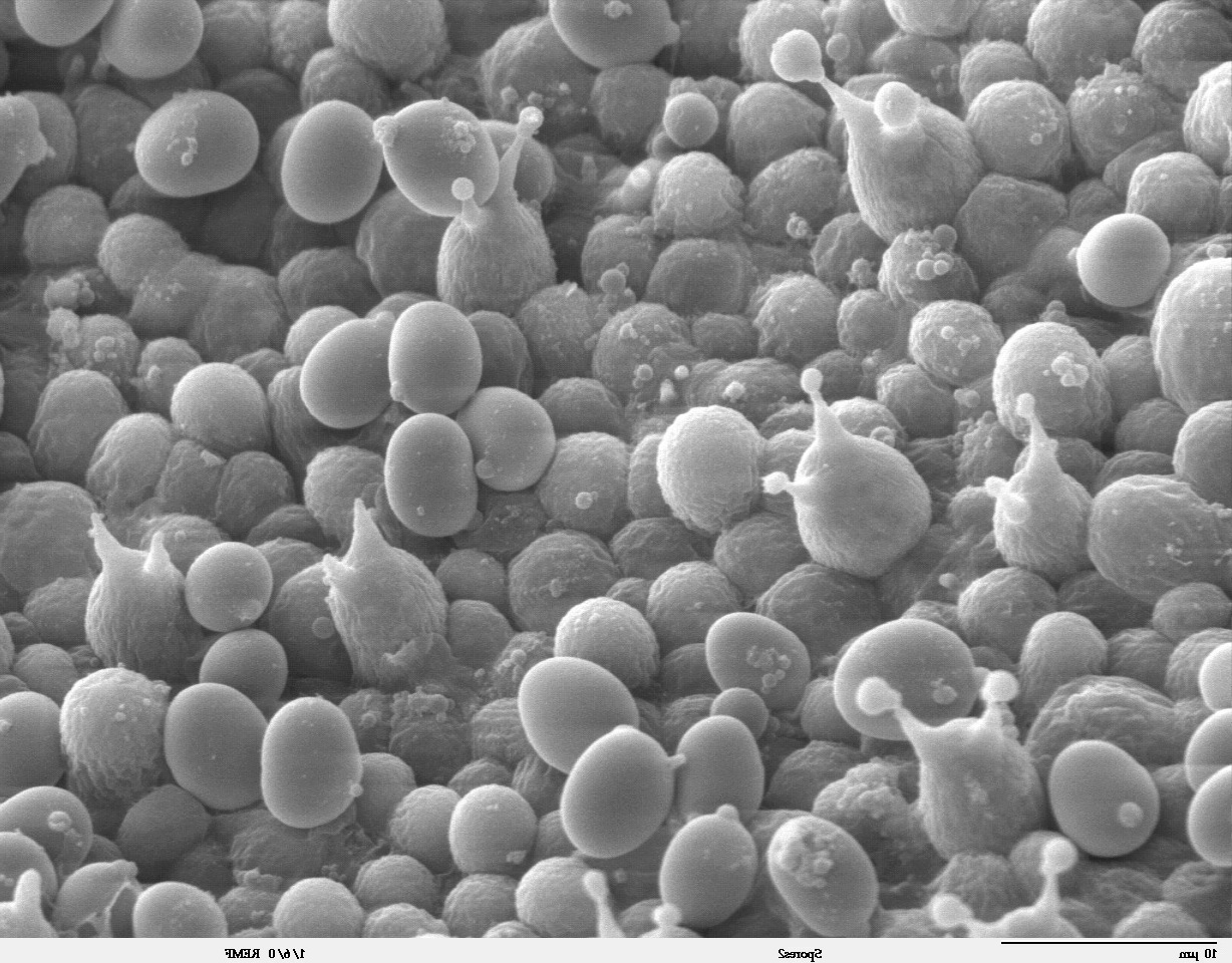 Imagen de esporas de hongos de la especie Agaricus bisporus tomadas con un microscopio electrnico.
