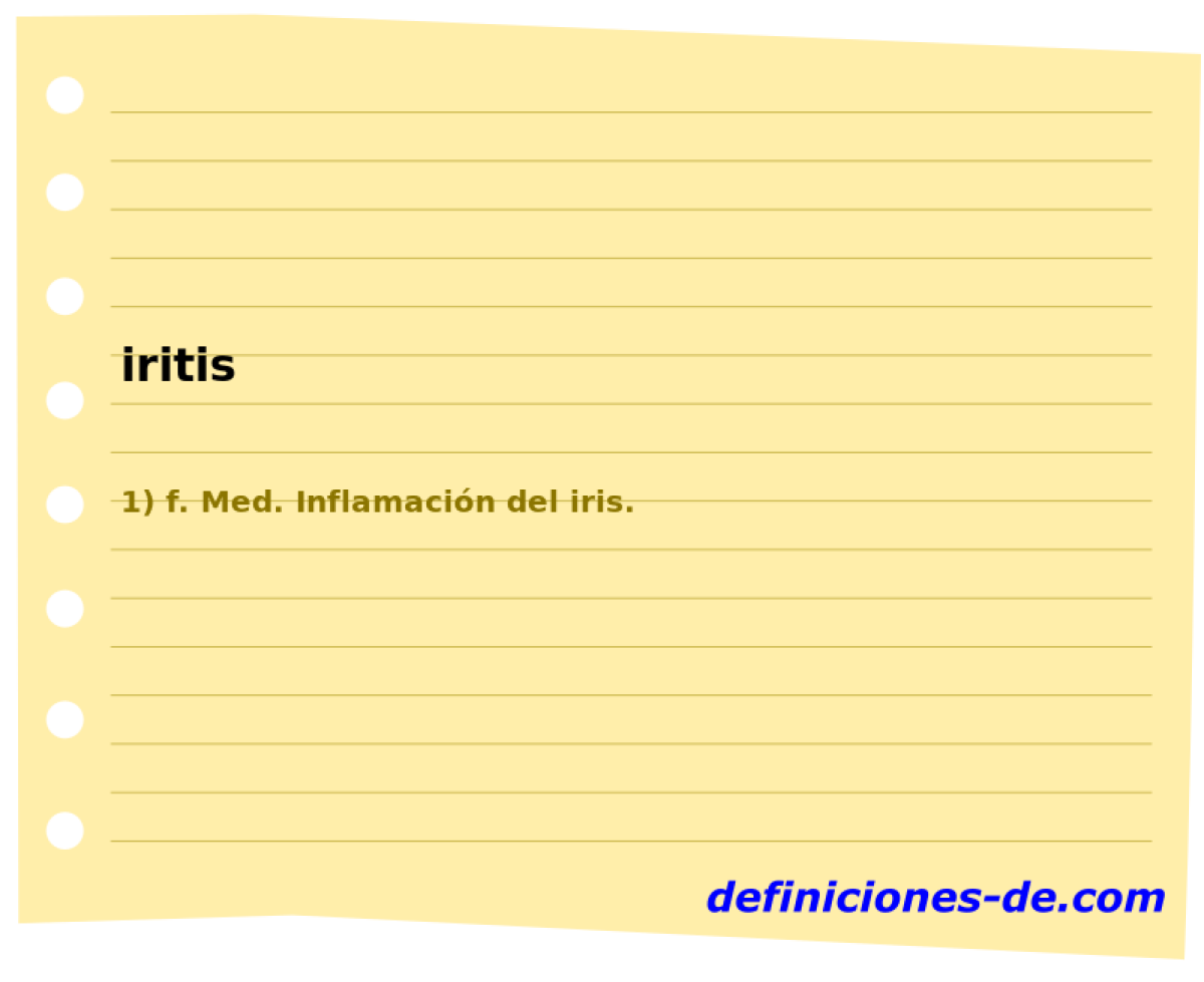 iritis 