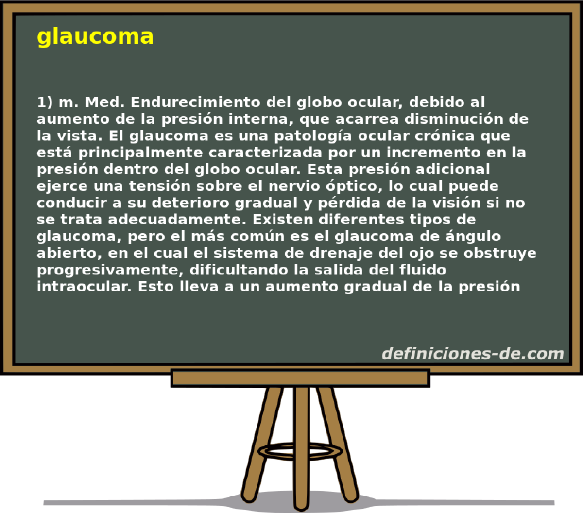 glaucoma 