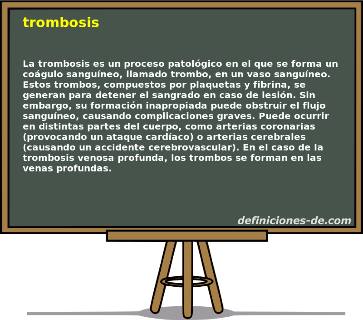 trombosis 