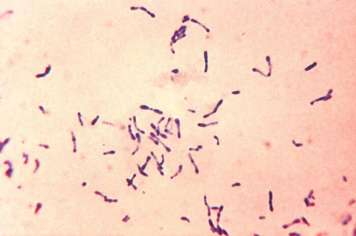 Bacterias Corynebacterium diphtheriae que producen el garrotillo