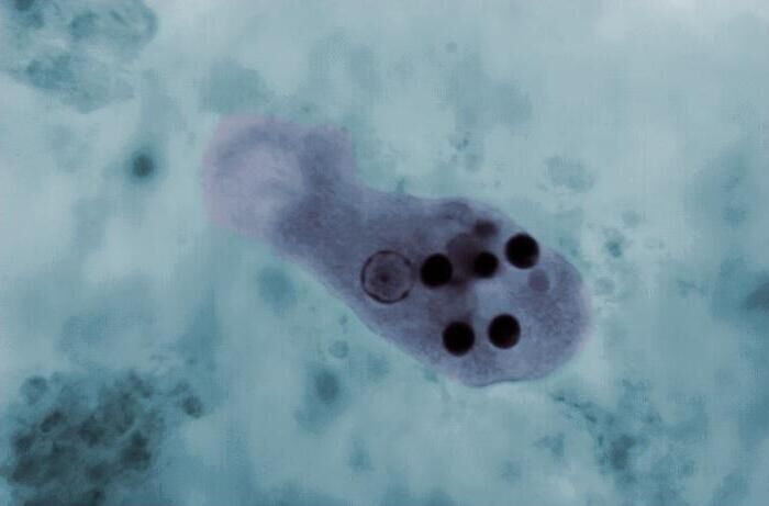 Microfotografa del parsito Entamoeba histolytica que causa la disentera