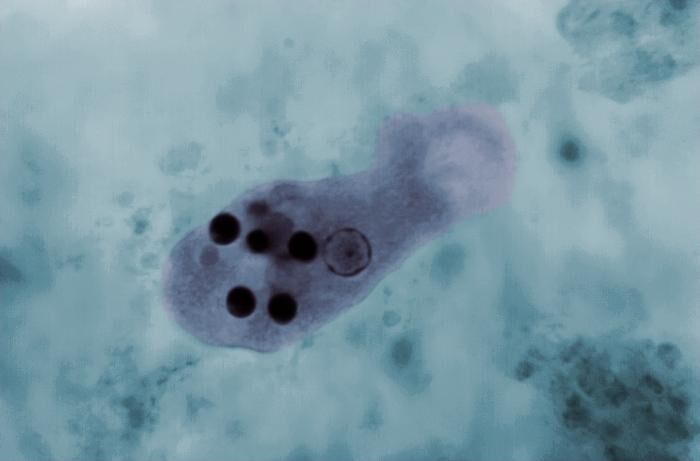 Ameba (Entamoeba histolytica)