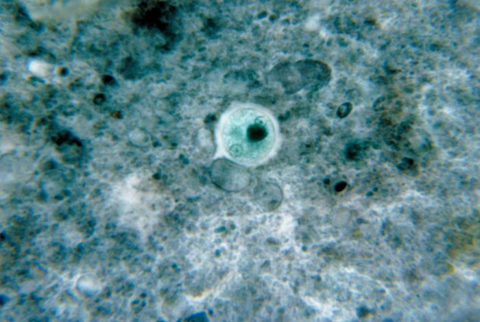 El parsito unicelular Entamoeba histolytica es fisparo
