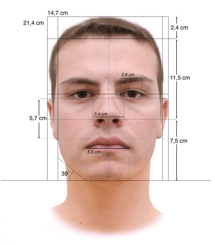 Atavismo o teora atvica: Medidas de la cara basadas en la antropologa criminal de Lombroso.
