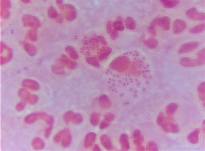 Blenorragia (Neisseria gonorrhoeae)