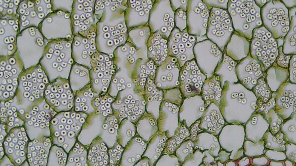 Sección transversal de una raíz de planta. Observen los gránulos de almidón en las células del tejido parenquimatoso