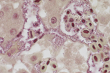 Bacterias Pasteurella o pasterela.