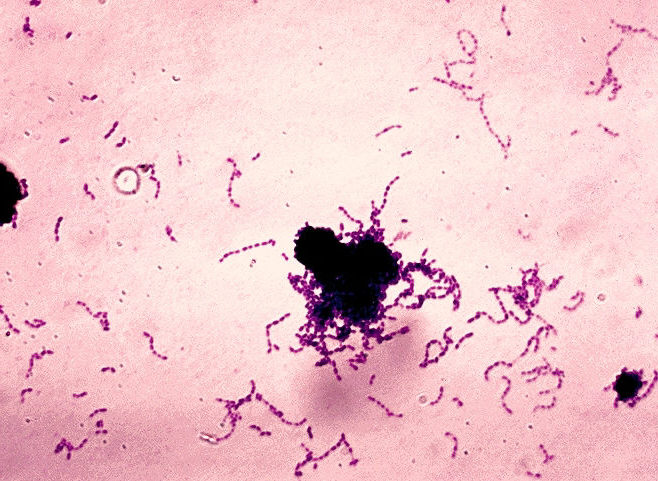 Streptococcus mutans: una especie de bacteria muy relacionada a la produccin de caries, que tiene un gran poder acidgeno, acidfilo y acidrico.