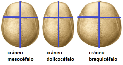 Resultado de imagen para DolicocÃ©falo