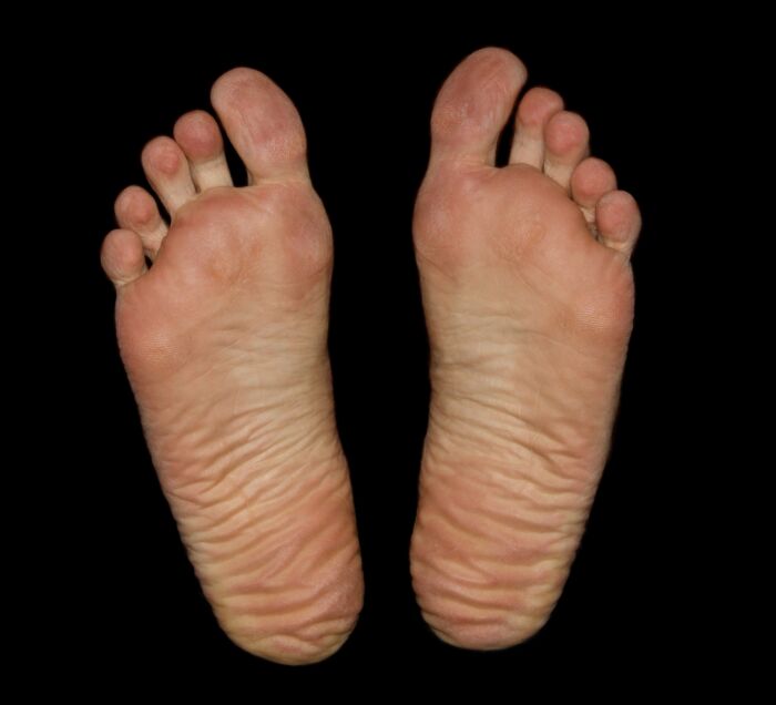 Pecueca: olor ftido de los pies sudados o sin higiene