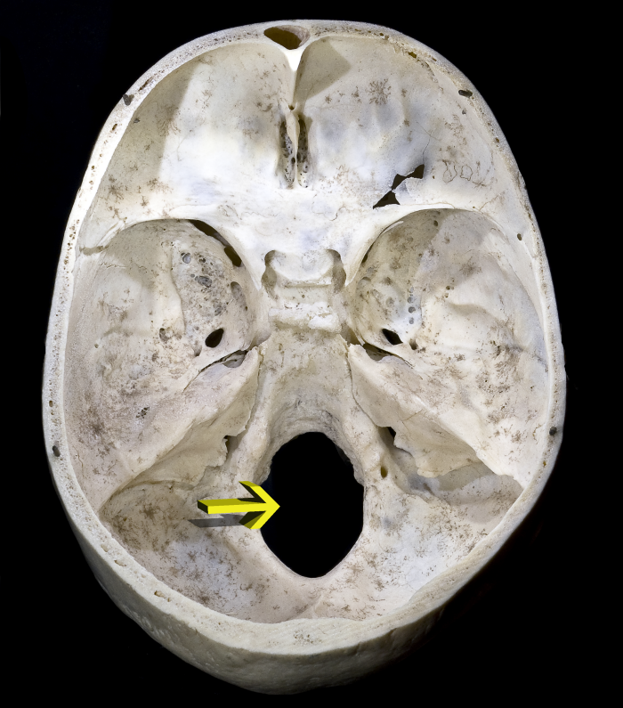 Una fotografa de la superficie interna inferior de un crneo humano. Foramen magnum en punta de flecha