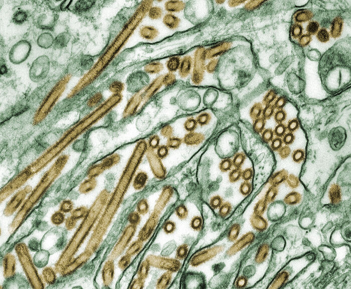 Microfotografa de virus A H5N1 da gripe aviaria