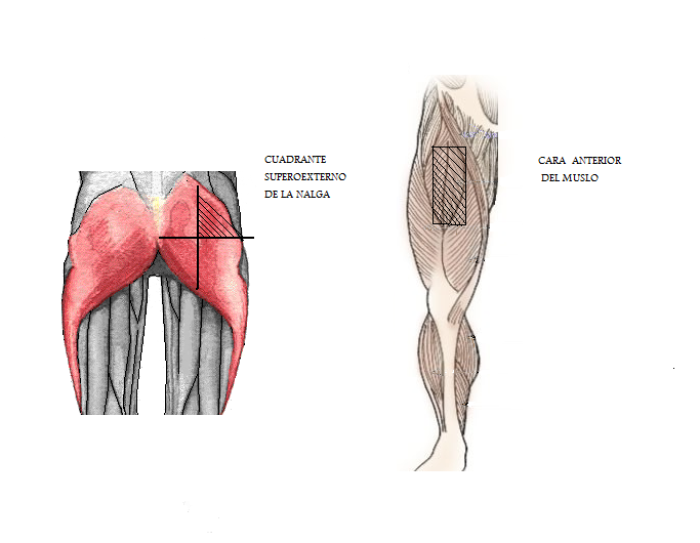 Vas tpicas para inyeccin intramuscular en piernas y gluteos