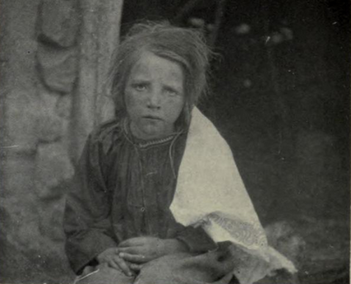 Un niño malnutrido (Imperio ruso, año 1917)