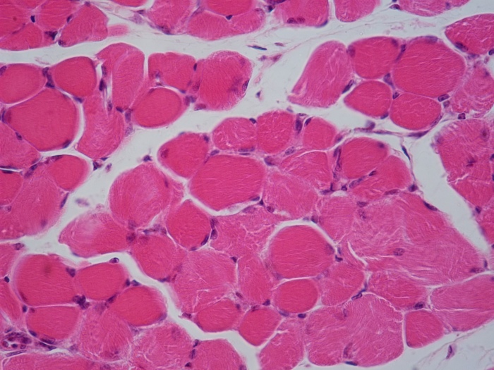 Corte transversal de msculo esqueltico estriado. Tincin con hematoxilina eosina; 400X. o