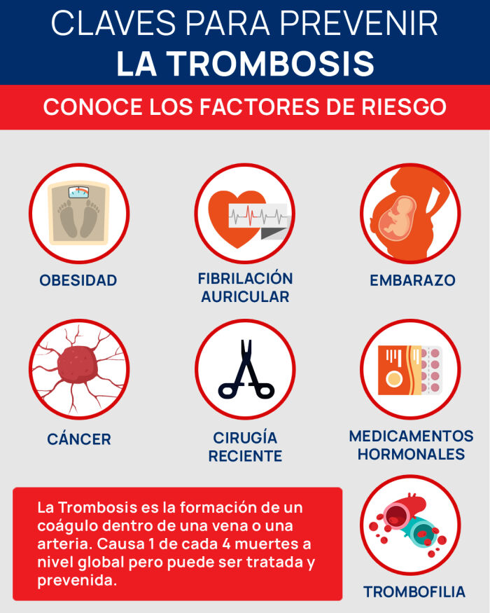 Trombosis: claves para prevenirla