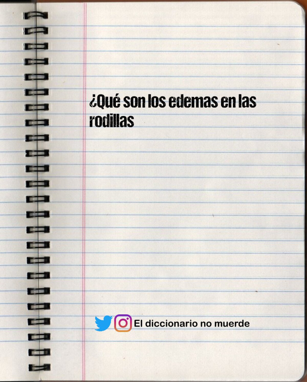 ¿Qué son los edemas en las rodillas