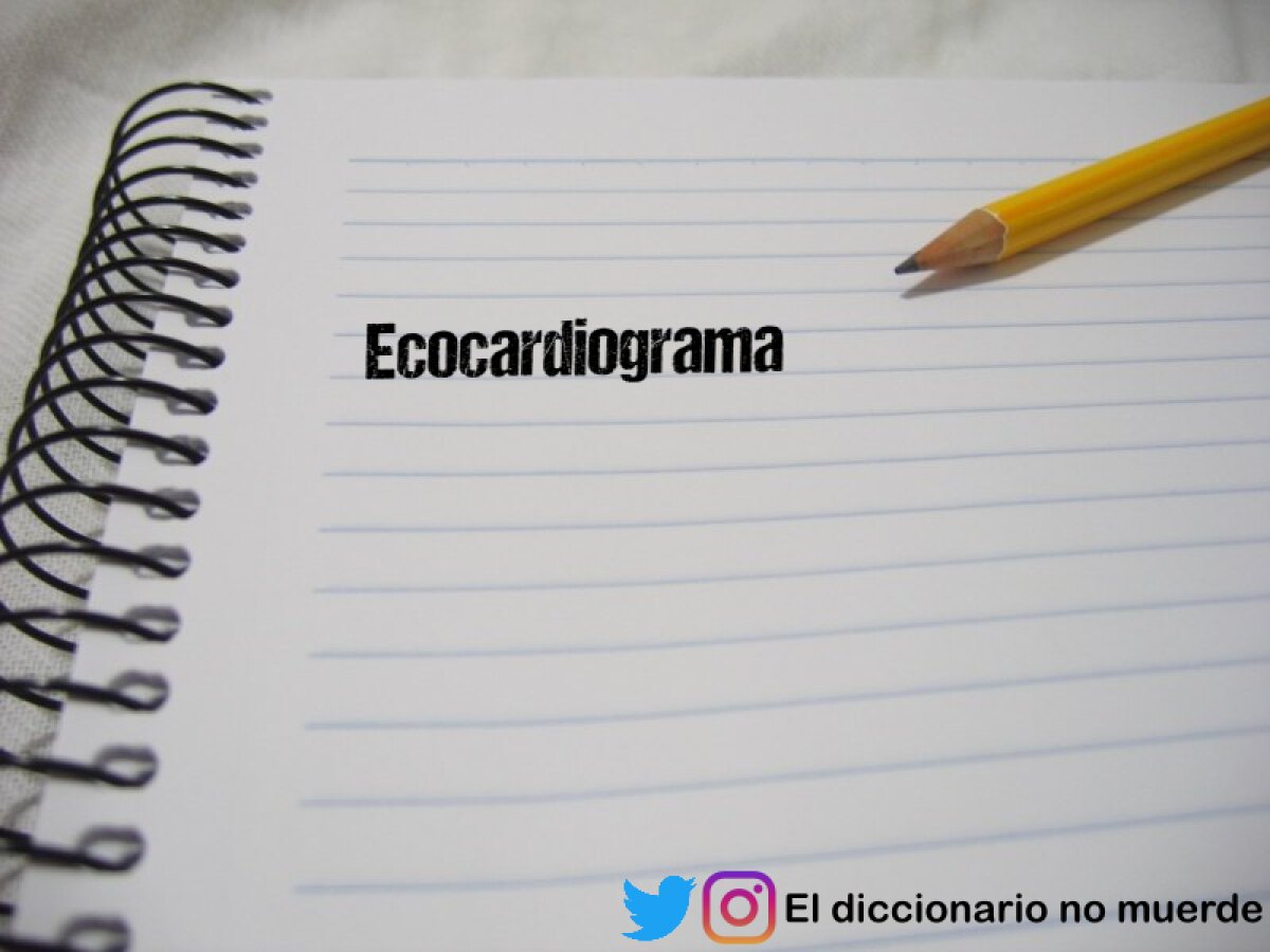 Ecocardiograma