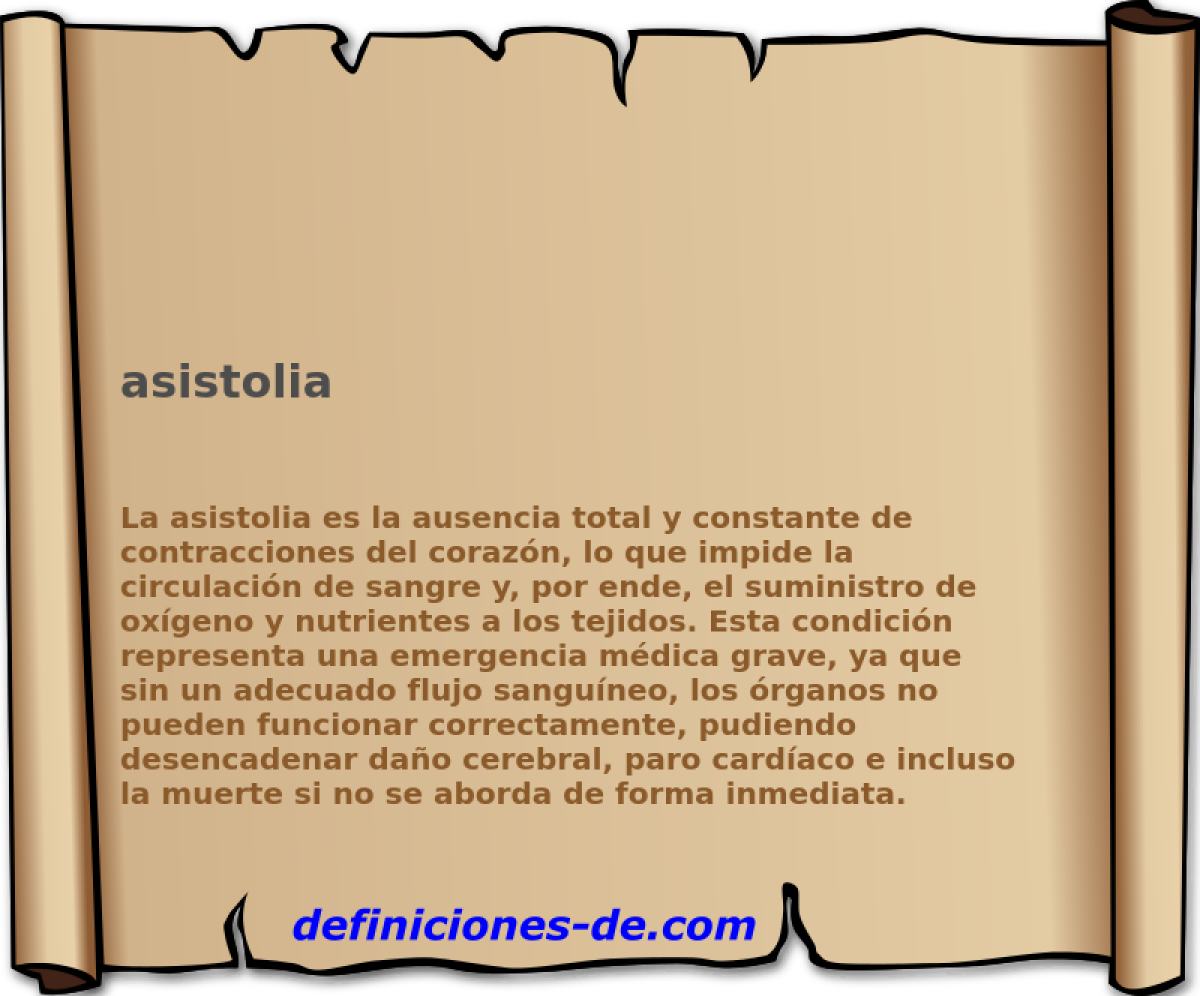 asistolia 