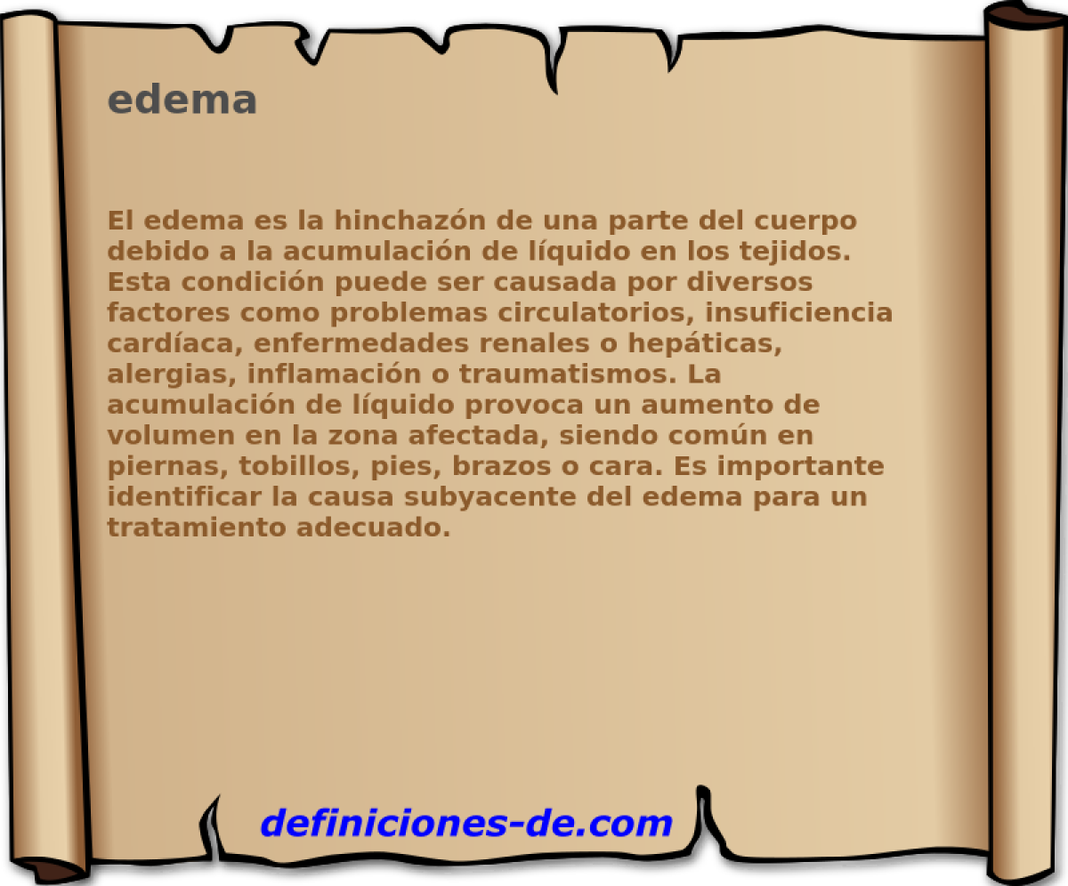 edema 