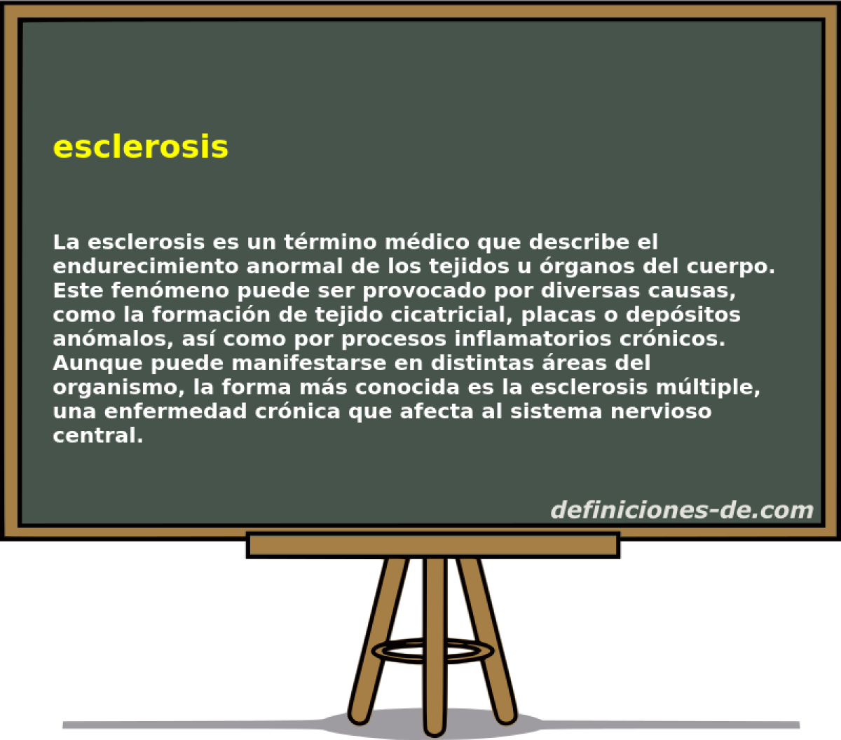 esclerosis 