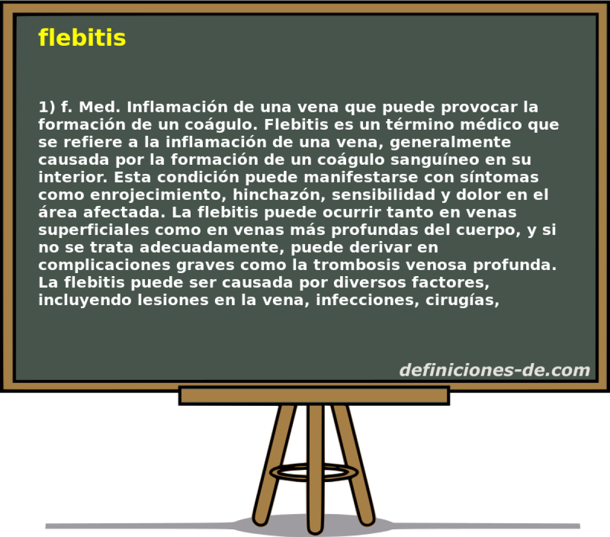 flebitis 