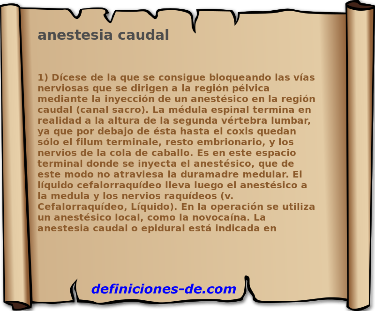 anestesia caudal 