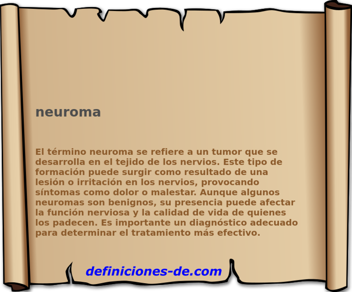 neuroma 