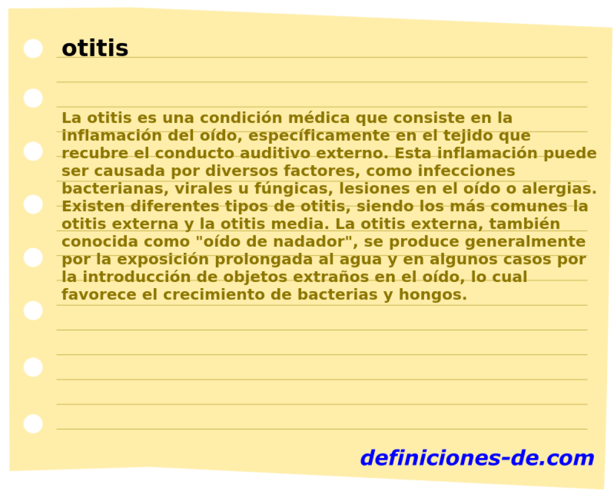 otitis 