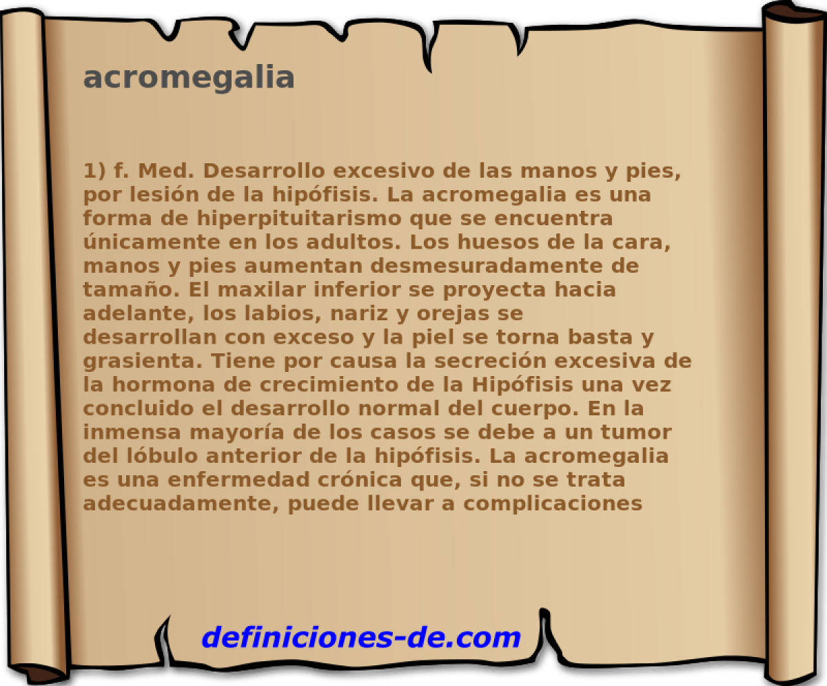 acromegalia 
