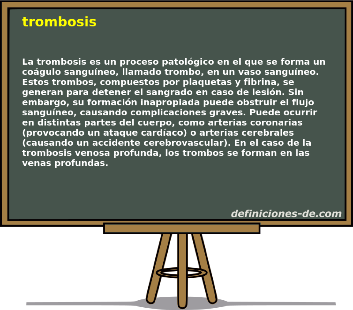 trombosis 