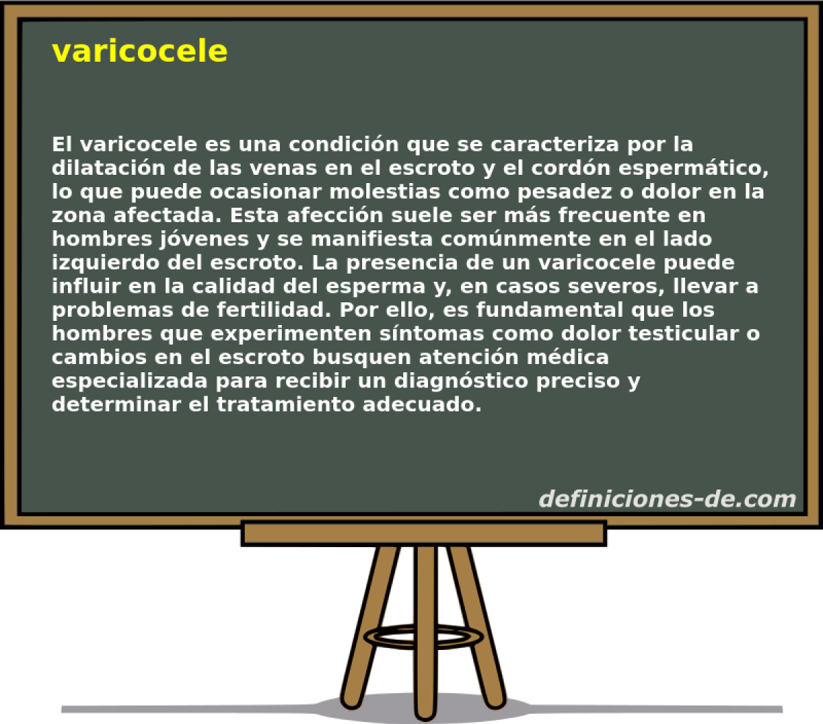 varicocele 