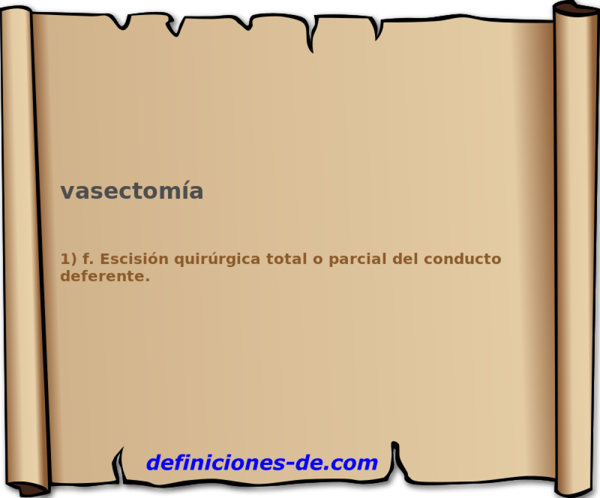 vasectoma 