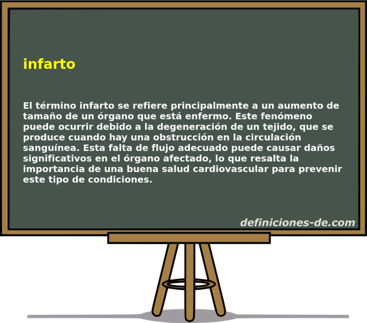 infarto 