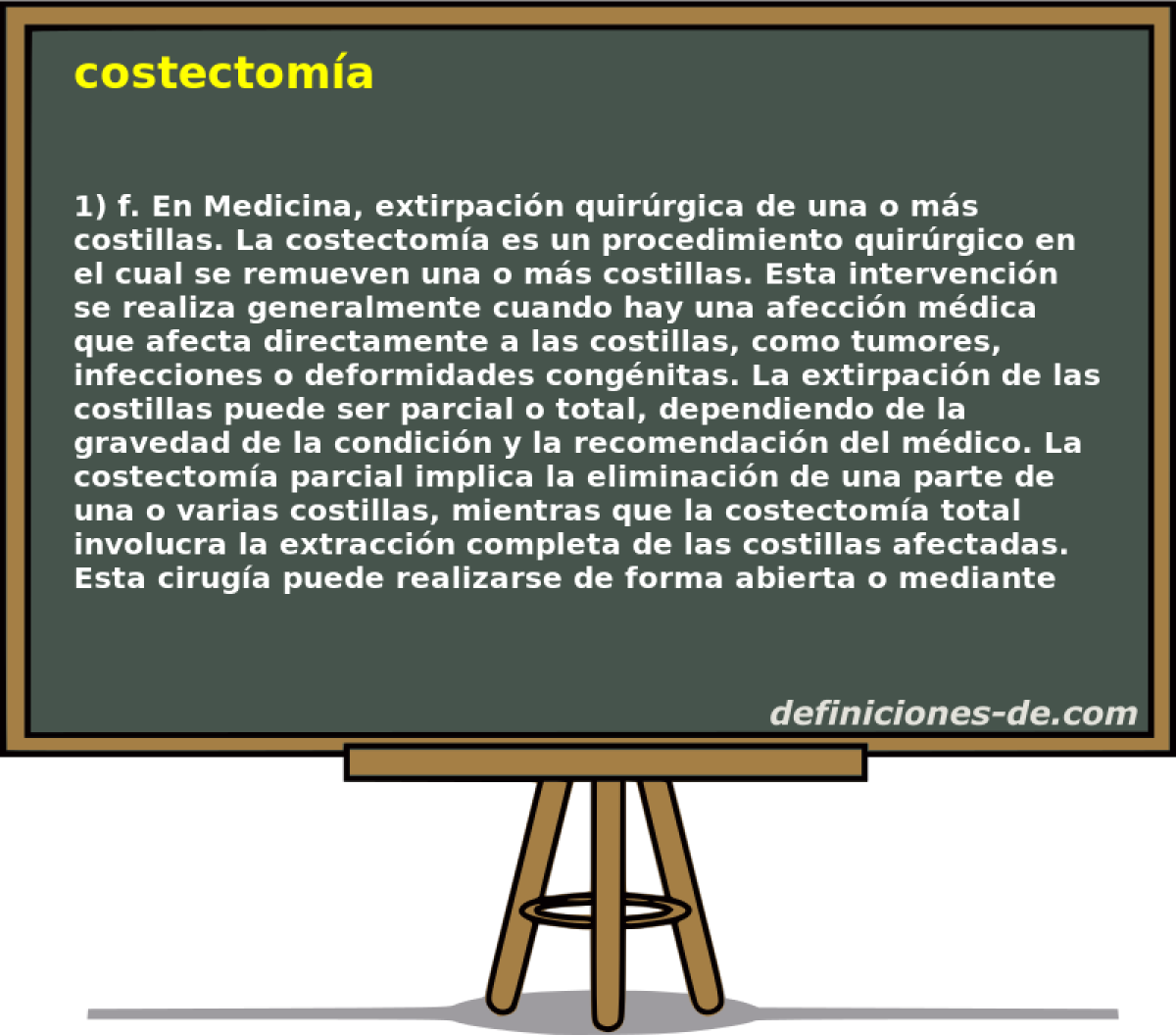 costectoma 