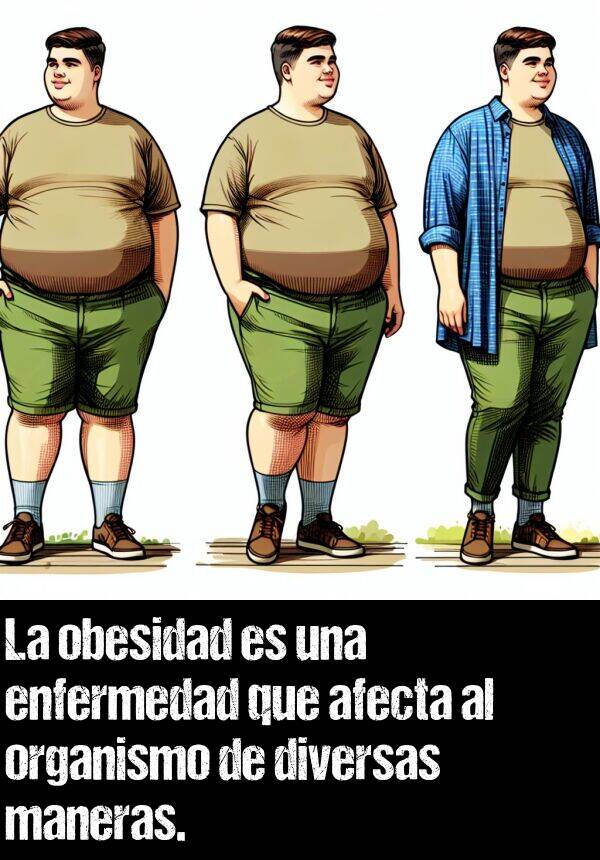 obesidad: La obesidad es una enfermedad que afecta al organismo de diversas maneras.
