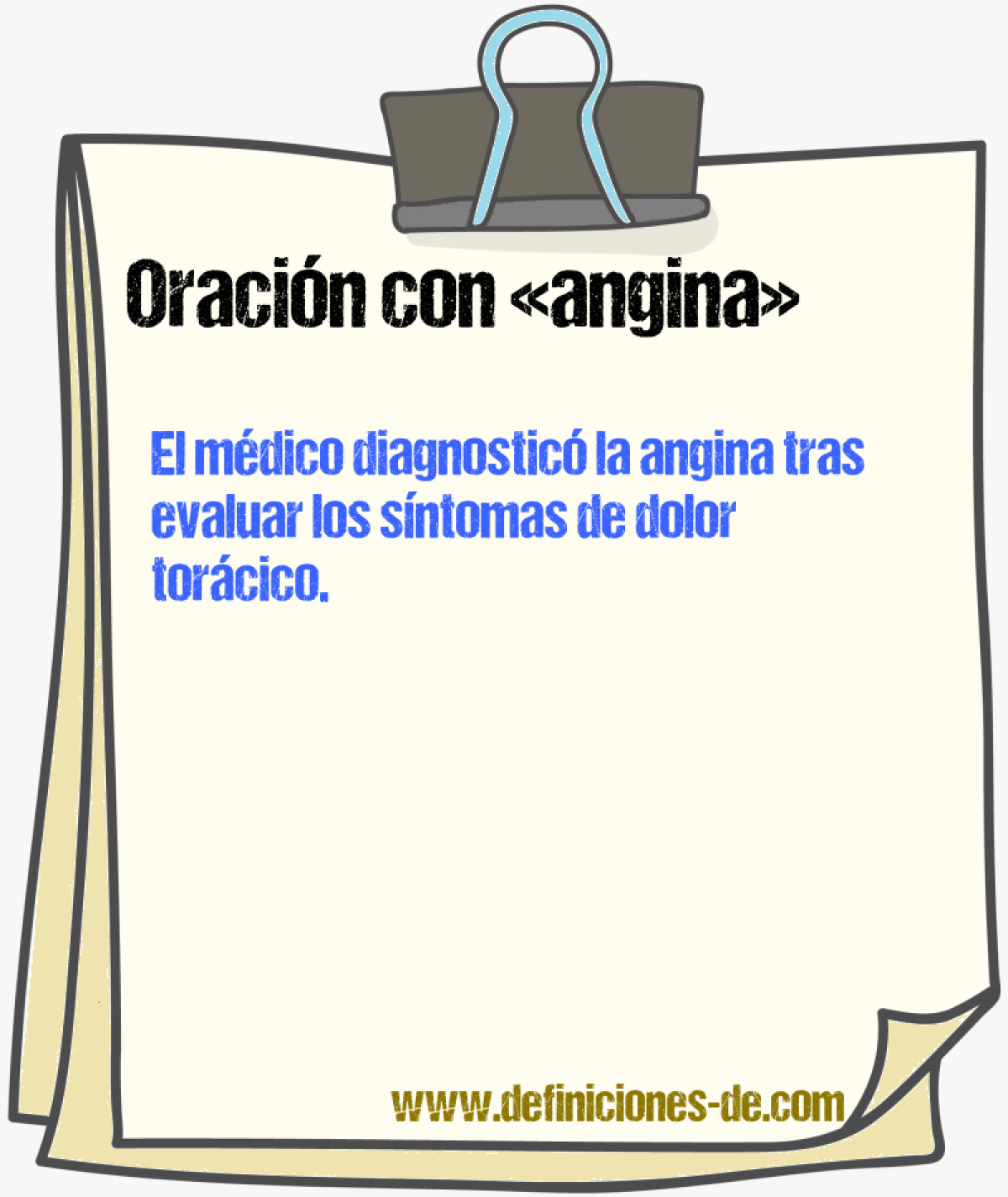 Ejemplos de oraciones con angina