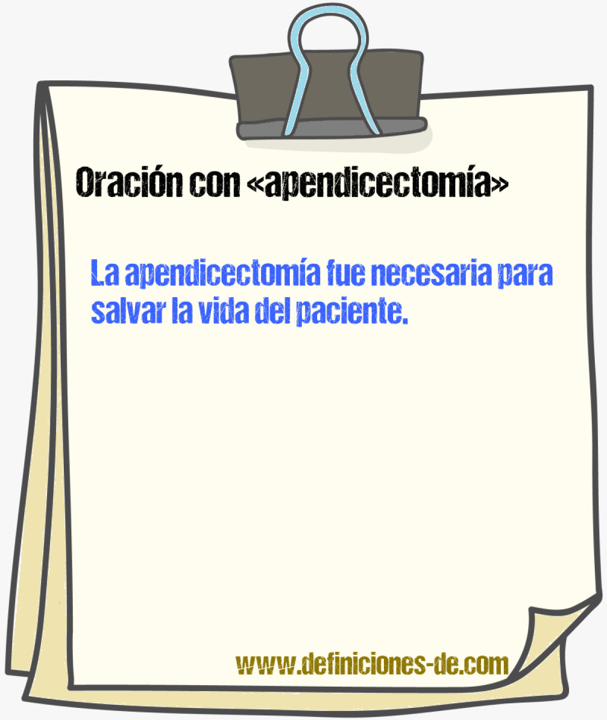 Ejemplos de oraciones con apendicectoma