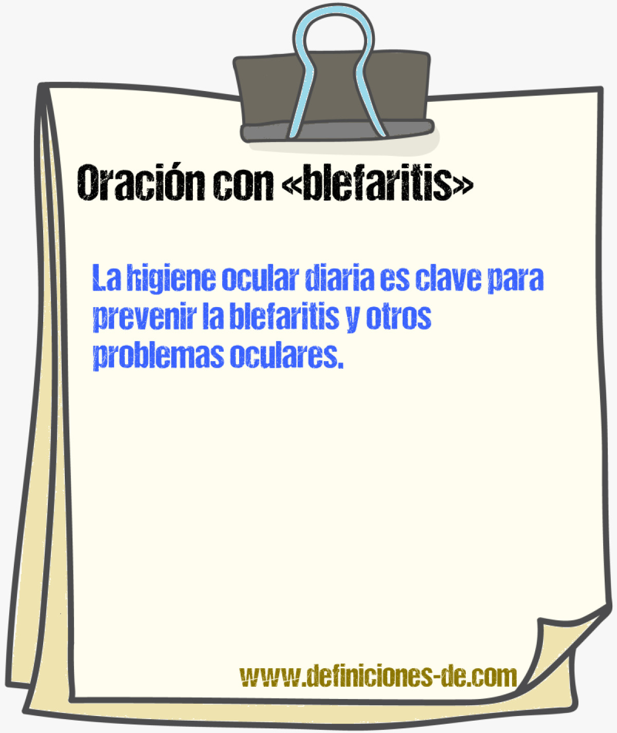 Ejemplos de oraciones con blefaritis