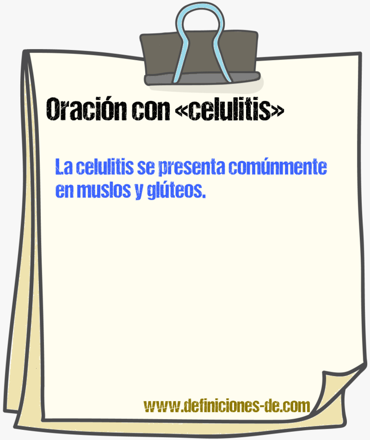 Ejemplos de oraciones con celulitis