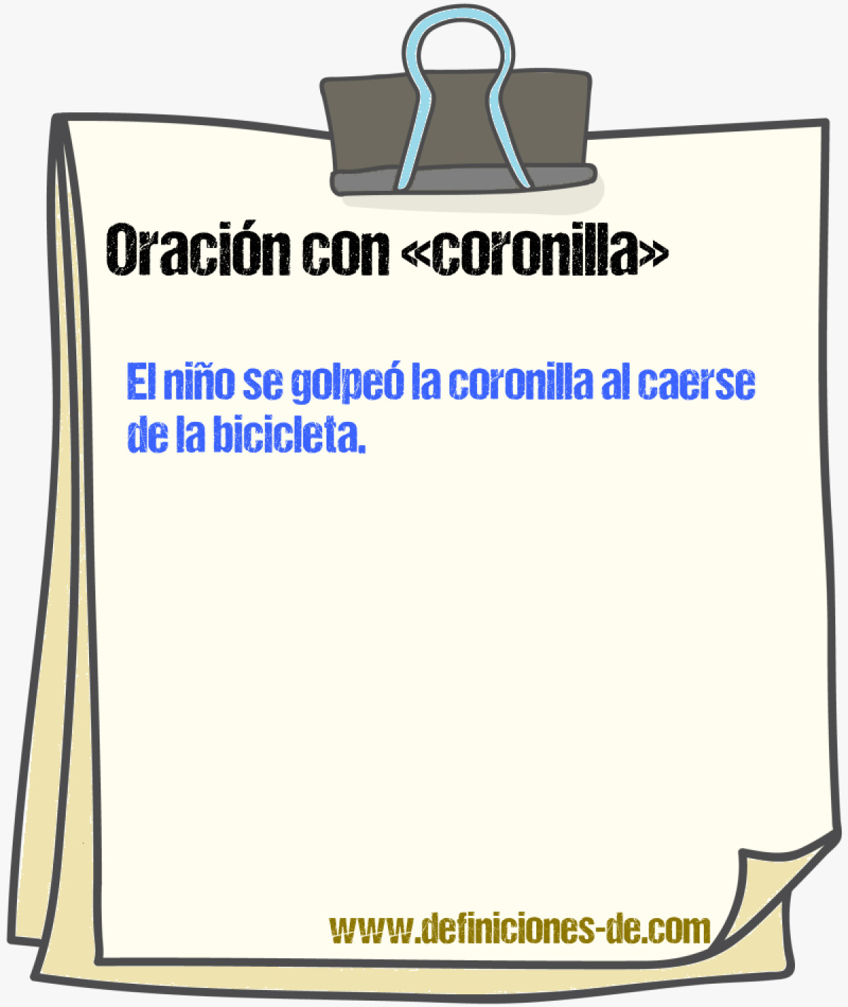 Ejemplos de oraciones con coronilla