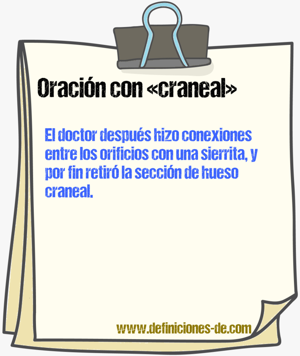 Ejemplos de oraciones con craneal