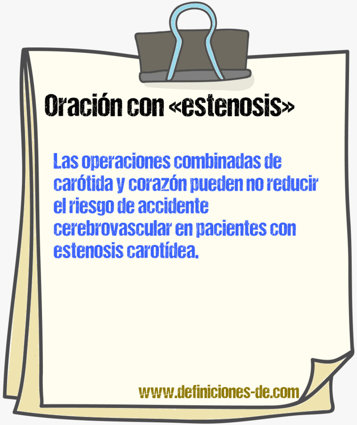 Ejemplos de oraciones con estenosis