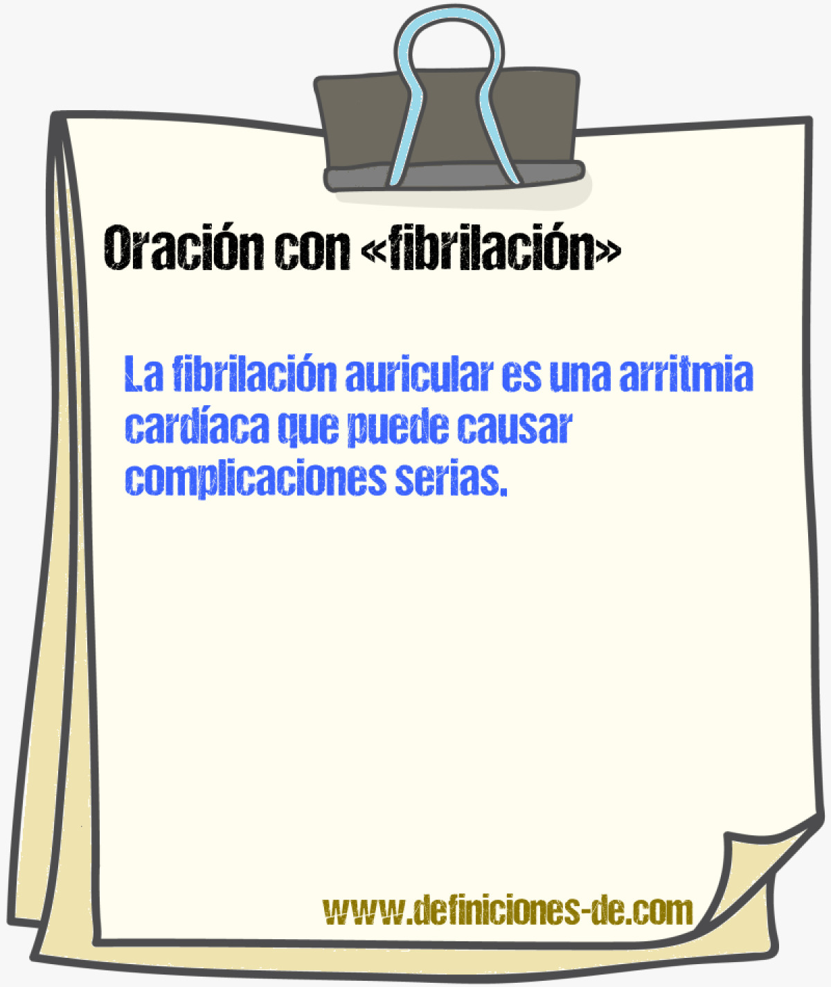 Ejemplos de oraciones con fibrilacin