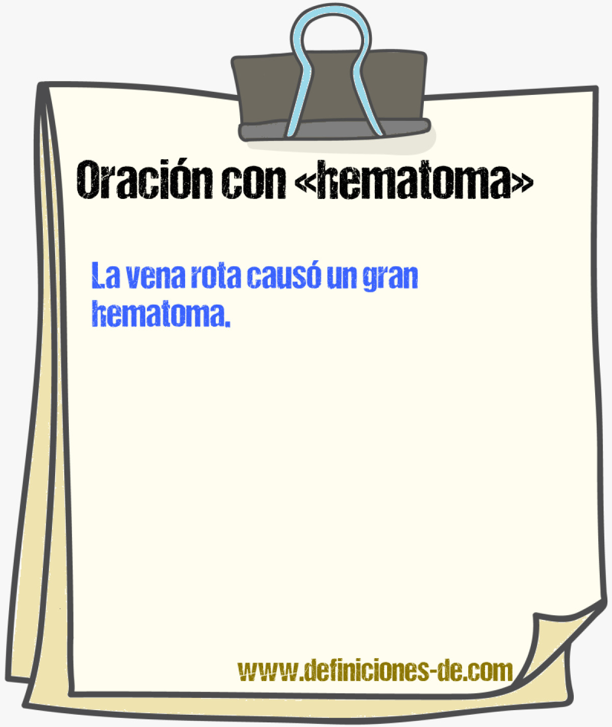 Ejemplos de oraciones con hematoma