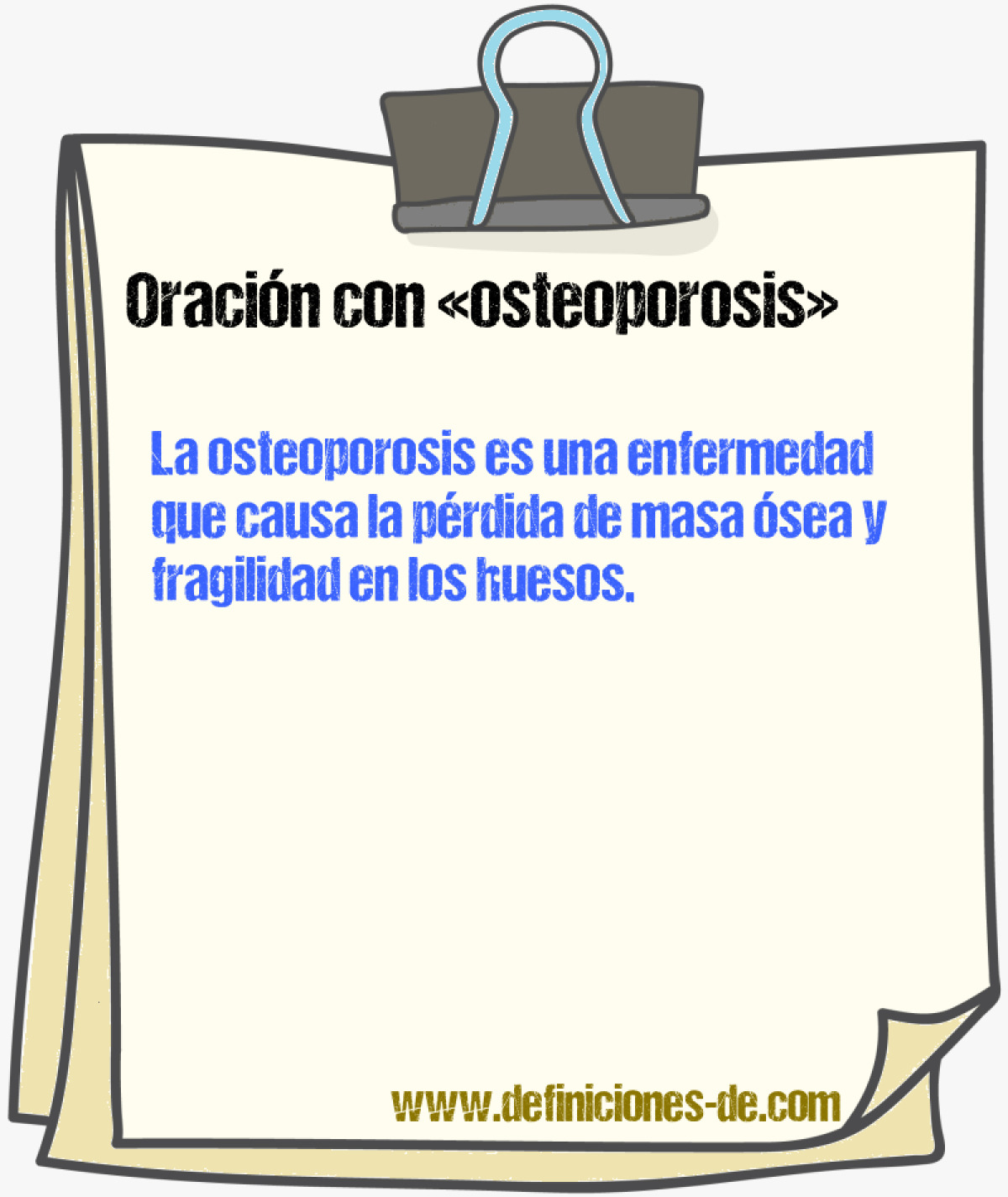 Ejemplos de oraciones con osteoporosis
