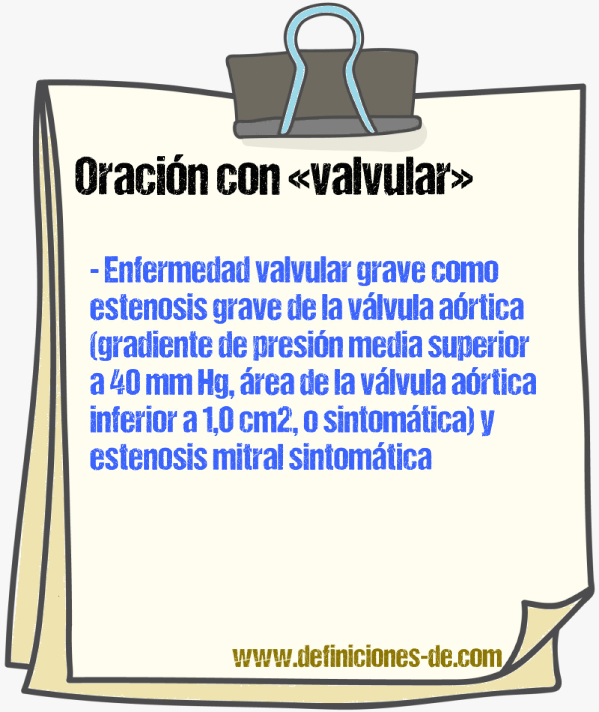 Ejemplos de oraciones con valvular